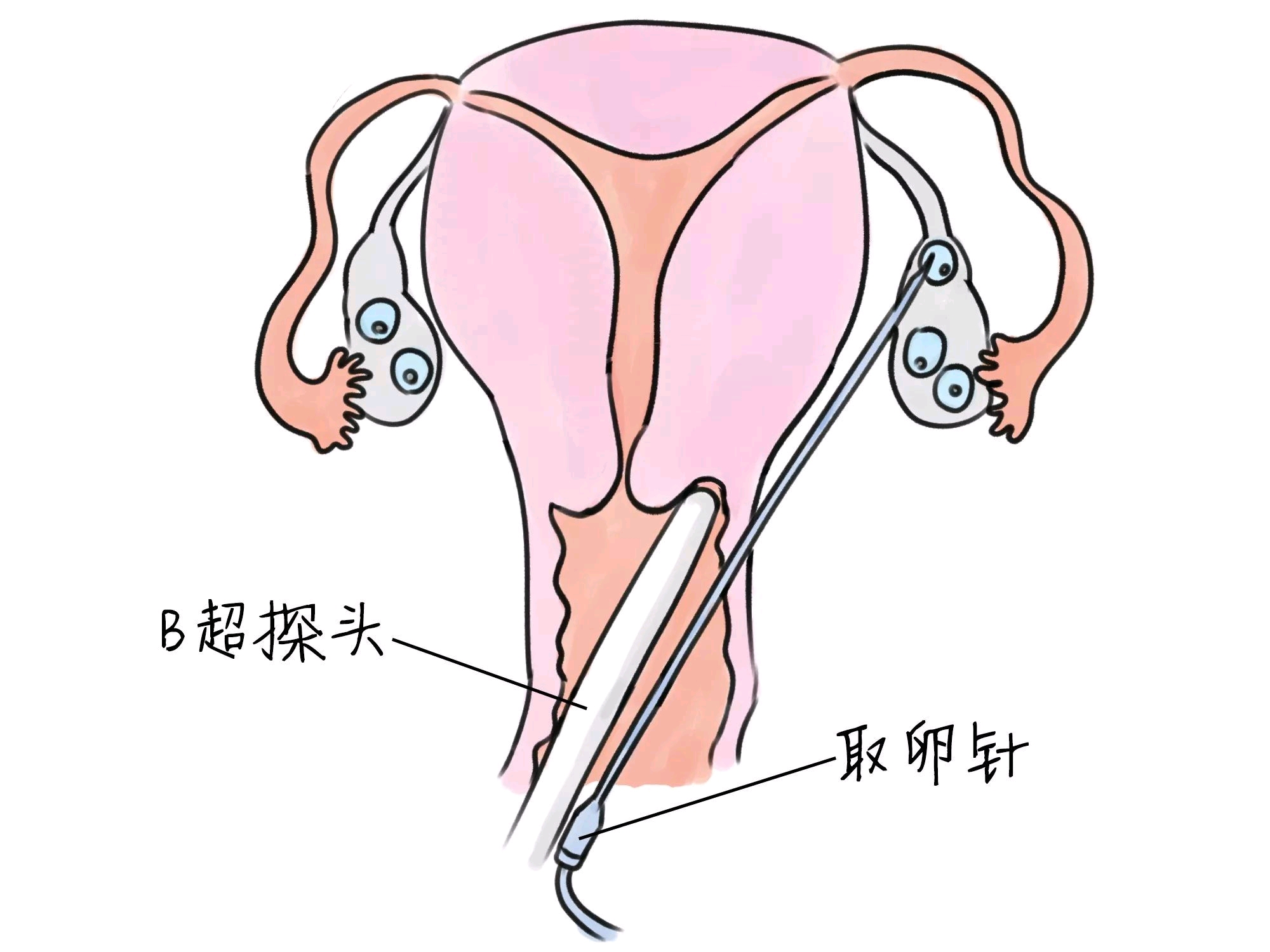代孕产子中介