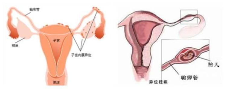 代孕中介退出