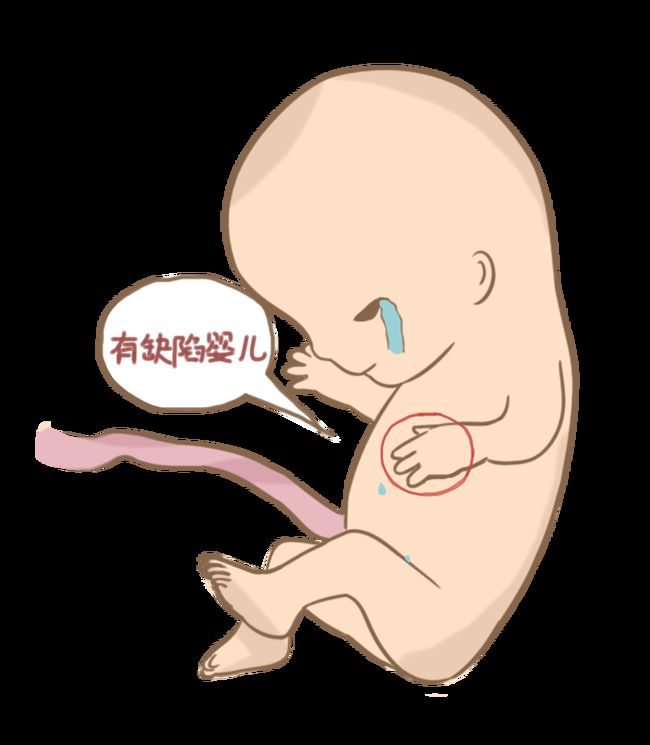 代孕产价格