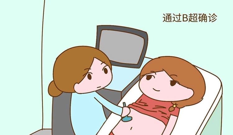 代孕