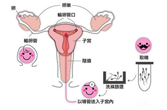 代孕