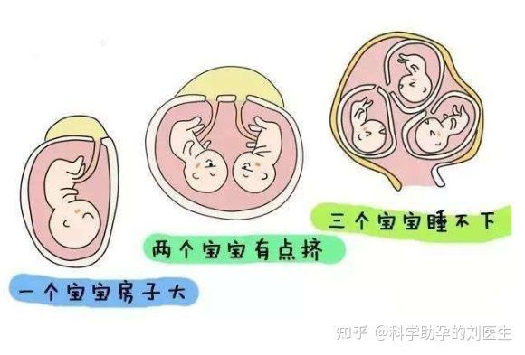 代孕
